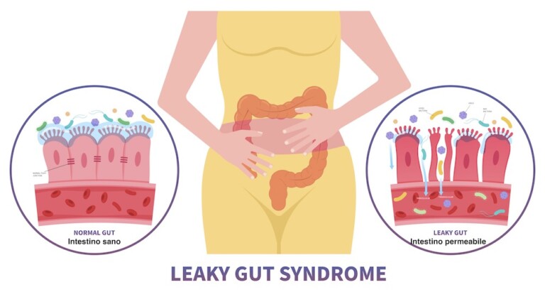 Gut microbiota e leaky gut: due termini da conoscere